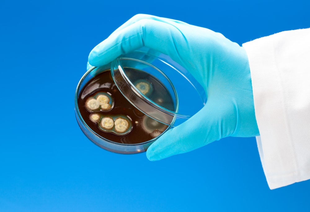 Mold in Lab Petri Dish